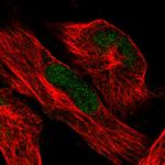 ATRX Antibody in Immunocytochemistry (ICC/IF)