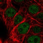 ATRX Antibody in Immunocytochemistry (ICC/IF)