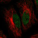 ATRX Antibody in Immunocytochemistry (ICC/IF)