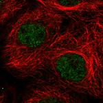 ATRX Antibody in Immunocytochemistry (ICC/IF)