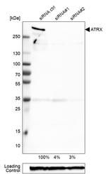 ATRX Antibody