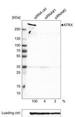 ATRX Antibody in Western Blot (WB)