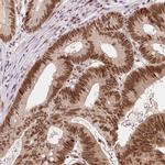 ZNF703 Antibody in Immunohistochemistry (IHC)