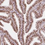 ZNF703 Antibody in Immunohistochemistry (IHC)