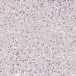 ZNF703 Antibody in Immunohistochemistry (IHC)