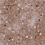 SLC22A2 Antibody in Immunohistochemistry (IHC)