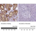 SLC22A2 Antibody