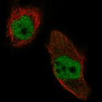 NSD2 Antibody in Immunocytochemistry (ICC/IF)