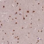 NSD2 Antibody in Immunohistochemistry (Paraffin) (IHC (P))