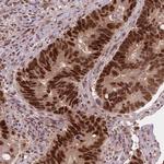 NSD2 Antibody in Immunohistochemistry (Paraffin) (IHC (P))