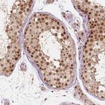 NSD2 Antibody in Immunohistochemistry (Paraffin) (IHC (P))