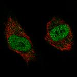 NSD2 Antibody in Immunocytochemistry (ICC/IF)