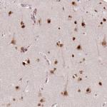 NSD2 Antibody in Immunohistochemistry (Paraffin) (IHC (P))