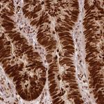 NSD2 Antibody in Immunohistochemistry (Paraffin) (IHC (P))