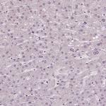 NSD2 Antibody in Immunohistochemistry (Paraffin) (IHC (P))