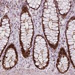 NSD2 Antibody in Immunohistochemistry (Paraffin) (IHC (P))