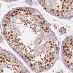 NSD2 Antibody in Immunohistochemistry (Paraffin) (IHC (P))