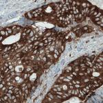 DIAPH2 Antibody in Immunohistochemistry (Paraffin) (IHC (P))