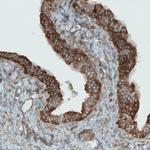 DIAPH2 Antibody in Immunohistochemistry (Paraffin) (IHC (P))