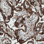 DIAPH2 Antibody in Immunohistochemistry (Paraffin) (IHC (P))