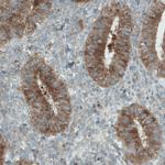 DIAPH2 Antibody in Immunohistochemistry (Paraffin) (IHC (P))