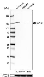 DIAPH2 Antibody in Western Blot (WB)