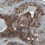 DIAPH2 Antibody in Immunohistochemistry (Paraffin) (IHC (P))