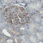 DIAPH2 Antibody in Immunohistochemistry (Paraffin) (IHC (P))