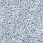 DIAPH2 Antibody in Immunohistochemistry (Paraffin) (IHC (P))