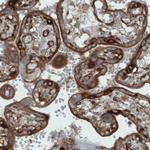 DIAPH2 Antibody in Immunohistochemistry (Paraffin) (IHC (P))