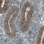 DIAPH2 Antibody in Immunohistochemistry (Paraffin) (IHC (P))