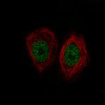 KDM5B Antibody in Immunocytochemistry (ICC/IF)