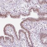 KDM5B Antibody in Immunohistochemistry (Paraffin) (IHC (P))