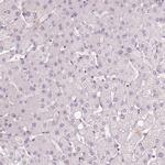 KDM5B Antibody in Immunohistochemistry (Paraffin) (IHC (P))