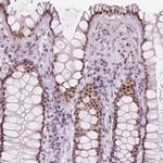 KDM5B Antibody in Immunohistochemistry (Paraffin) (IHC (P))