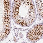 KDM5B Antibody in Immunohistochemistry (Paraffin) (IHC (P))