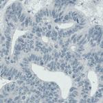 ALP Antibody in Immunohistochemistry (Paraffin) (IHC (P))