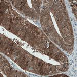 ALP Antibody in Immunohistochemistry (Paraffin) (IHC (P))