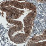 ALP Antibody in Immunohistochemistry (Paraffin) (IHC (P))