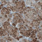 ALP Antibody in Immunohistochemistry (Paraffin) (IHC (P))