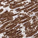 MYH6 Antibody in Immunohistochemistry (IHC)