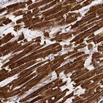 MYH6 Antibody in Immunohistochemistry (IHC)