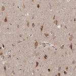 CARS Antibody in Immunohistochemistry (Paraffin) (IHC (P))