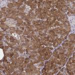 CARS Antibody in Immunohistochemistry (Paraffin) (IHC (P))