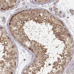 CARS Antibody in Immunohistochemistry (Paraffin) (IHC (P))