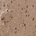 CARS Antibody in Immunohistochemistry (Paraffin) (IHC (P))