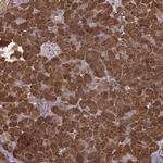 CARS Antibody in Immunohistochemistry (Paraffin) (IHC (P))