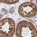 CARS Antibody in Immunohistochemistry (Paraffin) (IHC (P))