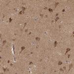 CARS Antibody in Immunohistochemistry (Paraffin) (IHC (P))