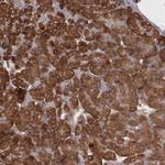 CARS Antibody in Immunohistochemistry (Paraffin) (IHC (P))